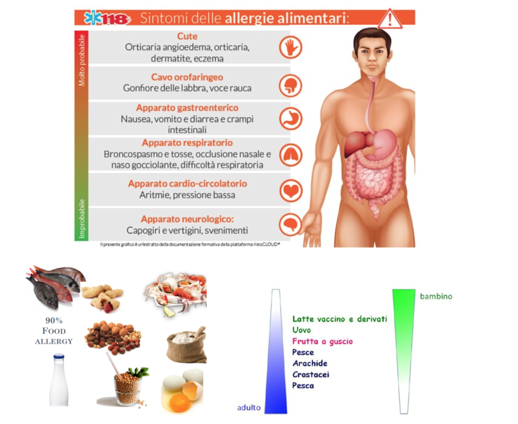 sintomi allergie alimentari